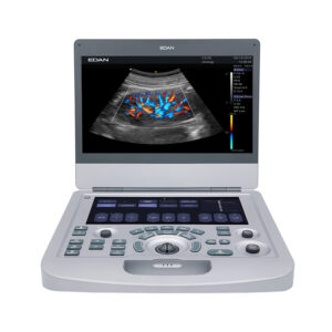 Edan AX18/AX28 Ultrasound