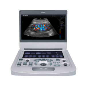 Edan AX2/AX3 Ultrasound