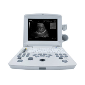 Edan DUS60 Ultrasound