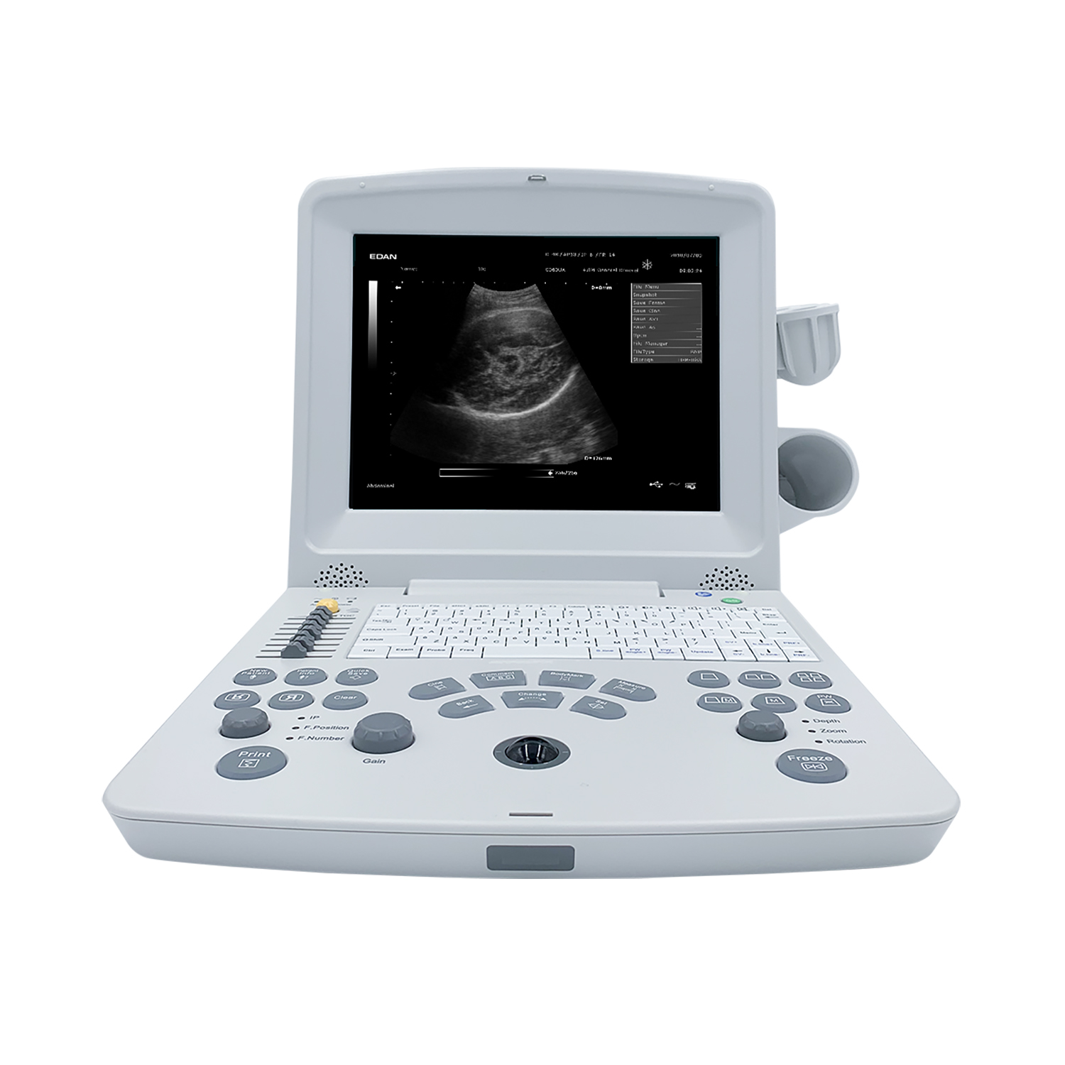 Edan DUS60 Ultrasound