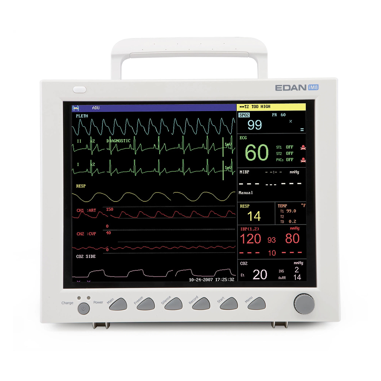 Edan iM8 Patient Monitor