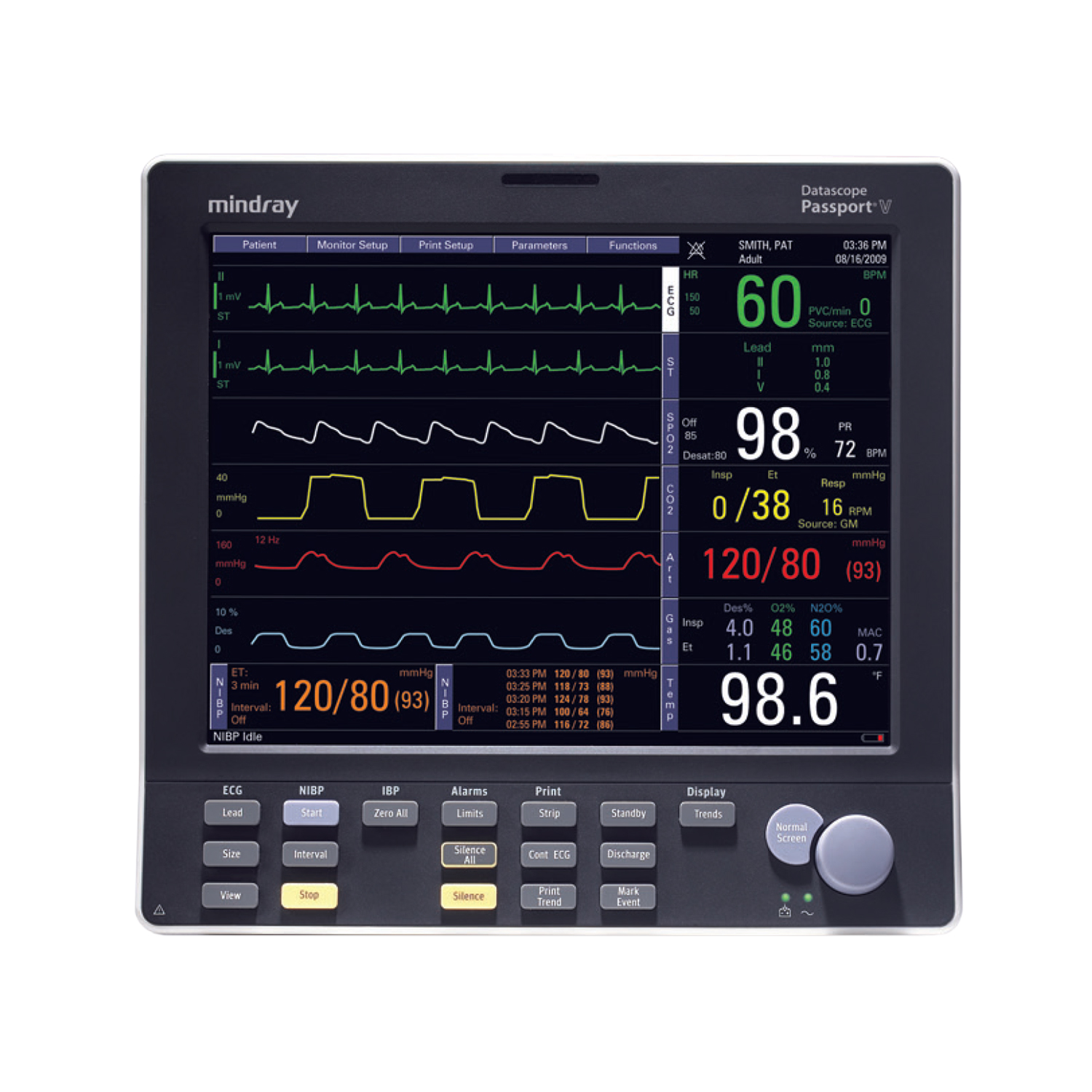 Mindray Passport V Patient Monitor