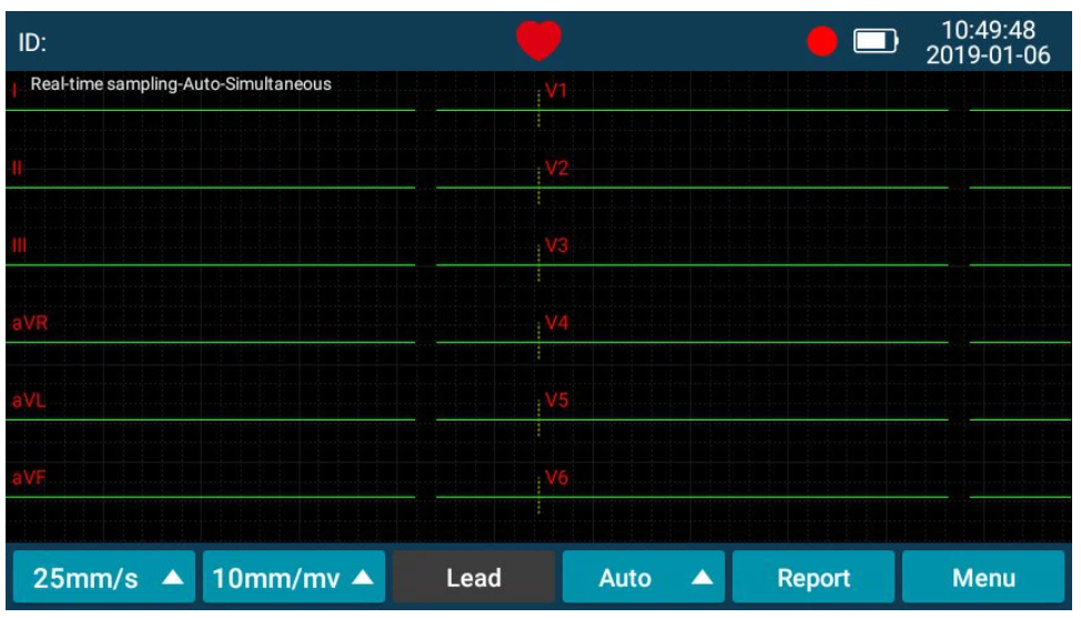 Signal quality — red indicates electrode issue