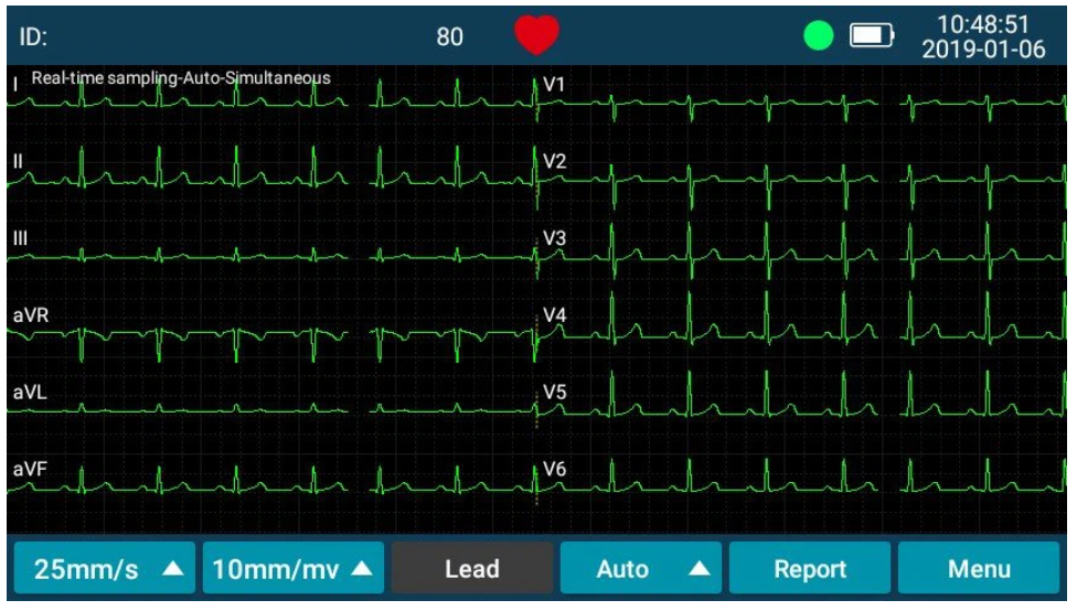 Real-time 12-lead sampling — clean signal