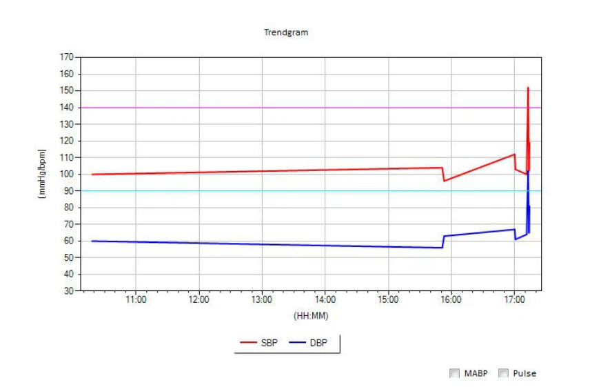 24-hour trendgram