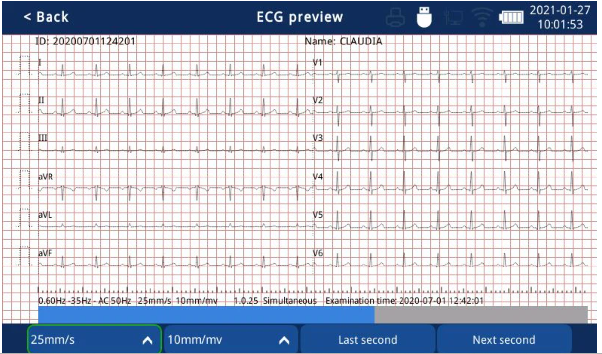 ECG preview and edit