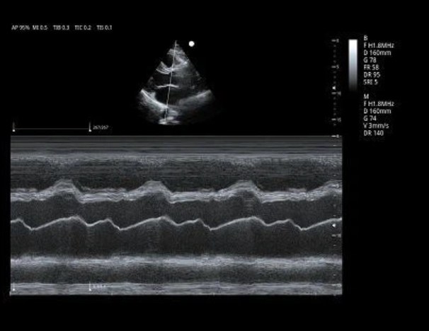 Cardiac M-Mode