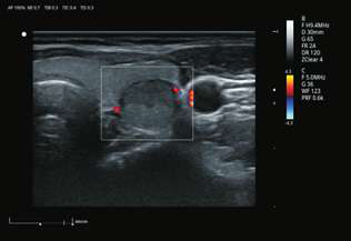 MicroFlow Imaging