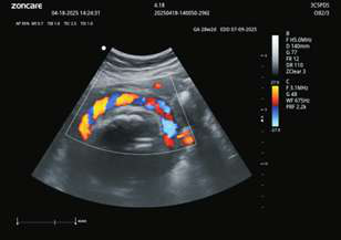 Intelligent blood flow tracking
